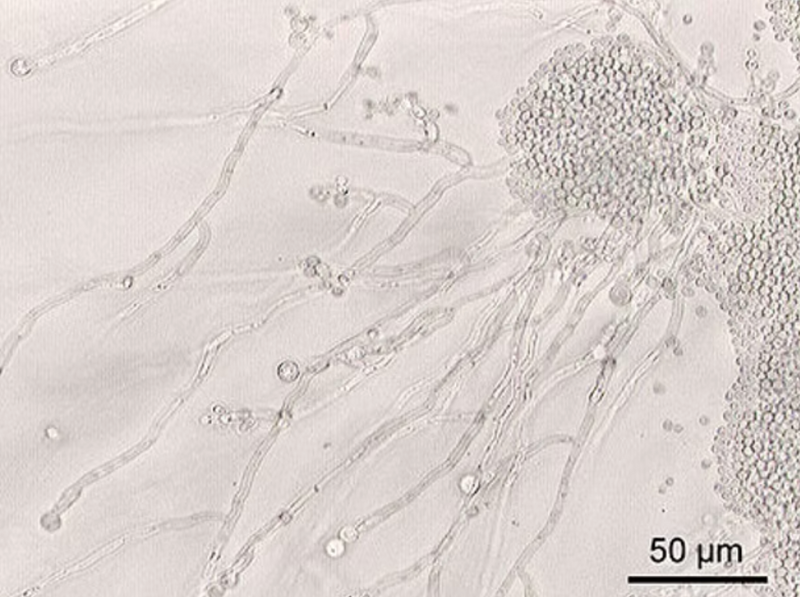 Does Hypochlorous Acid Kill Candida?