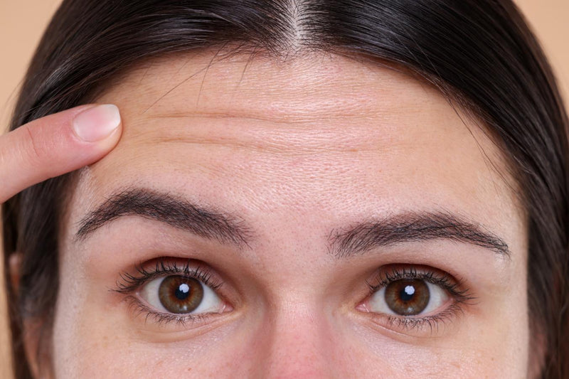 How to Get Rid of Forehead Lines: Effective Tips That Actually Work