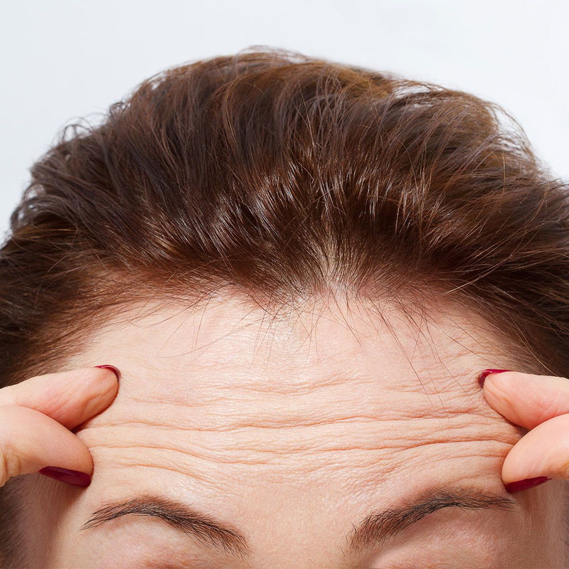 wrinkles