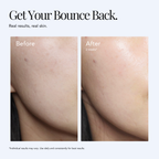 Barrier Bounce Copper Peptide Serum