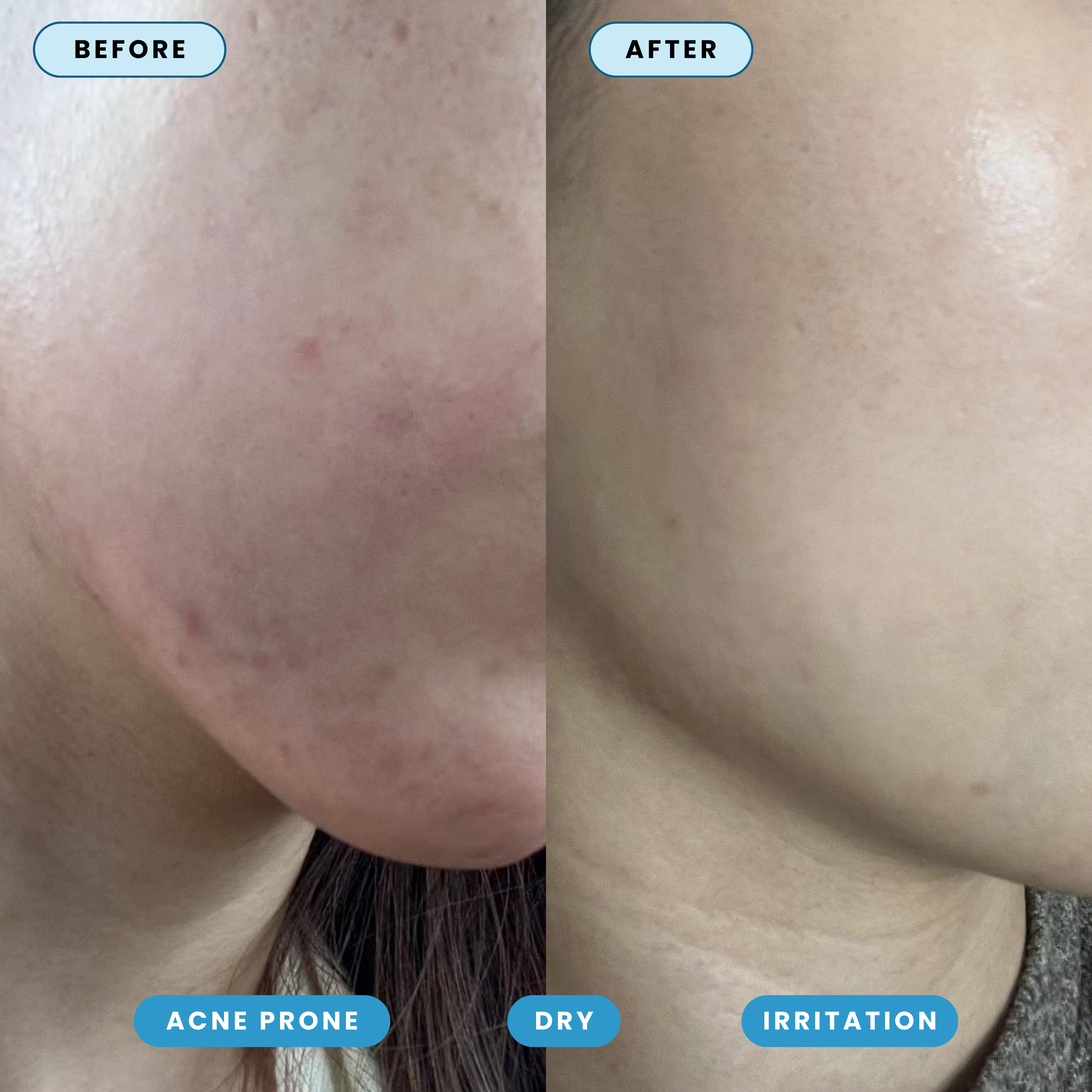 Hypochlorous Acid Spray - Cleanse & Soothe