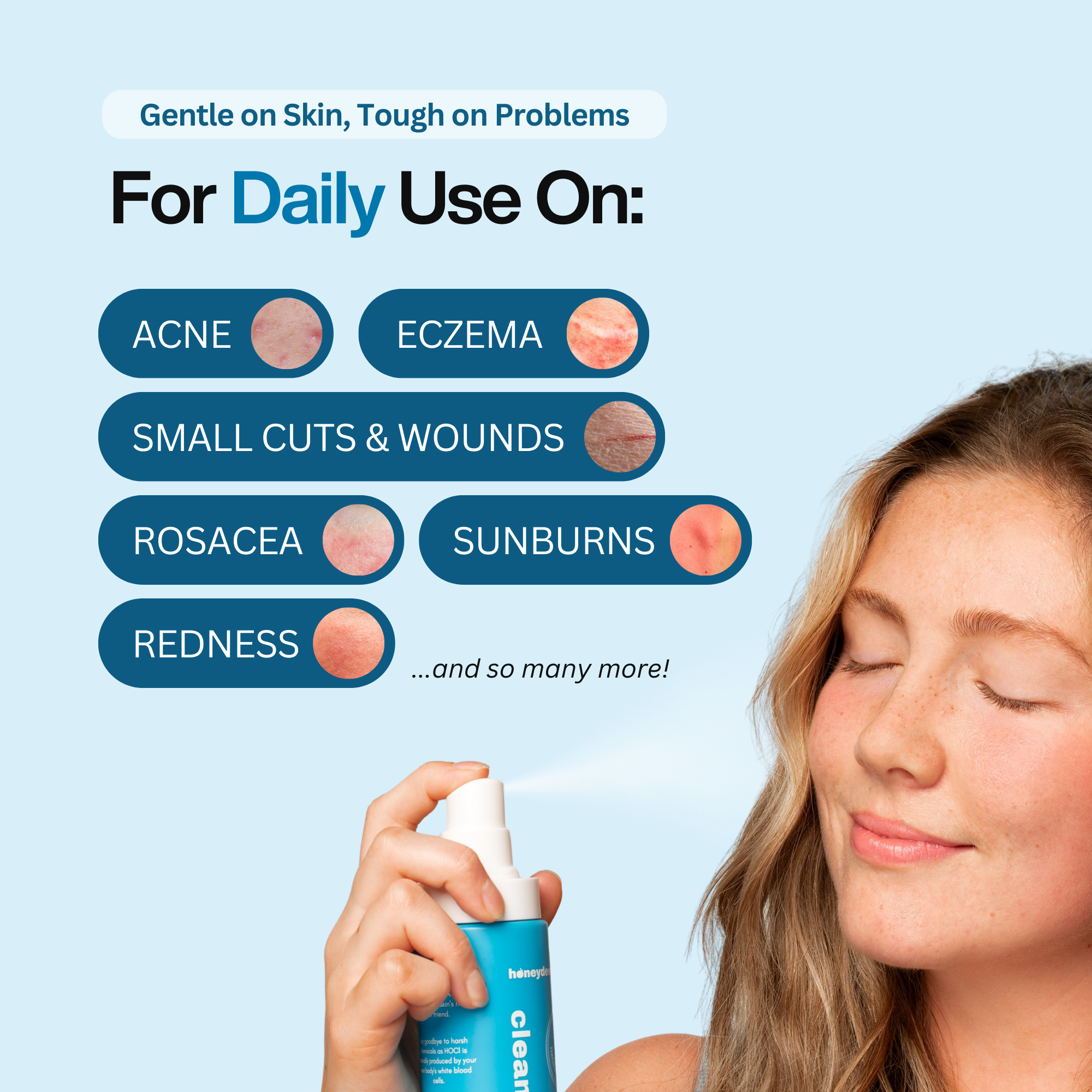 Hypochlorous Acid Spray - Cleanse & Soothe