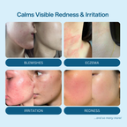 Hypochlorous Acid Spray