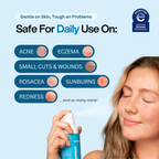 Hypochlorous Acid Spray