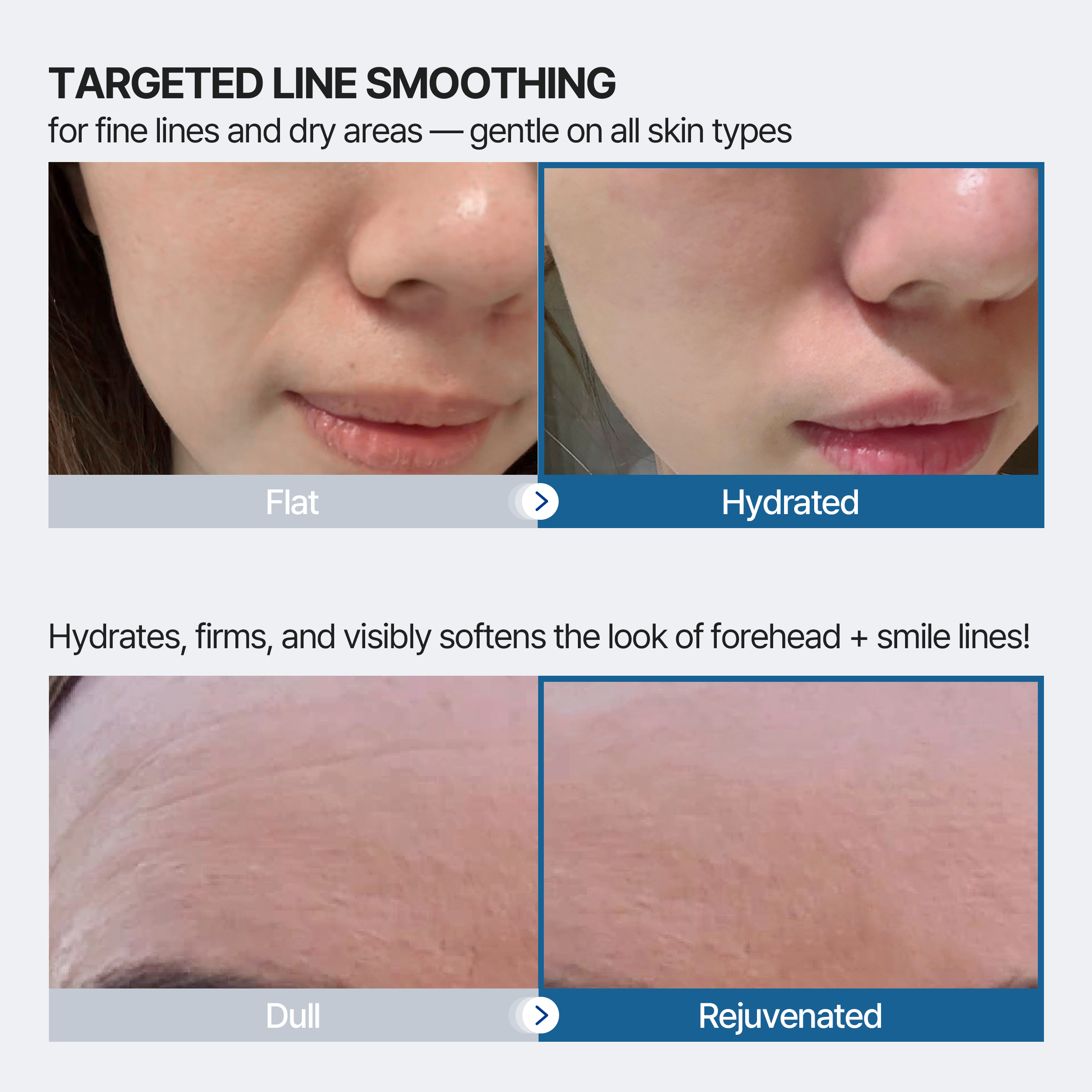 Forehead and Smile Line Wrinkle Patches